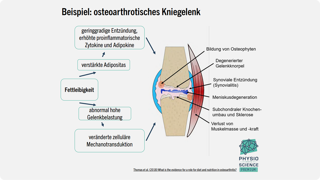Beispiel osteoarthrotisches Kniegelenk